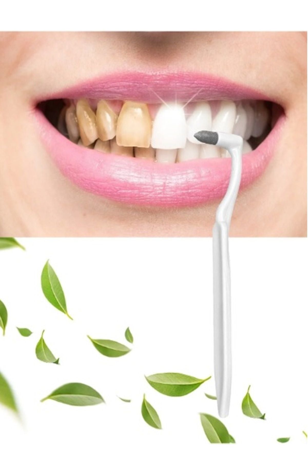 Tartar and stain remover dental eraser