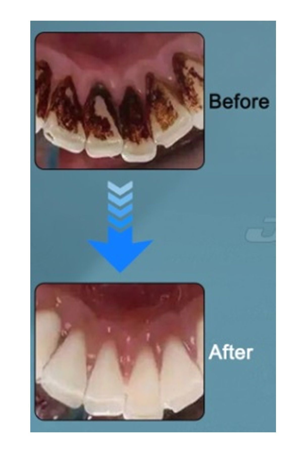 Orthodontic oral care brush